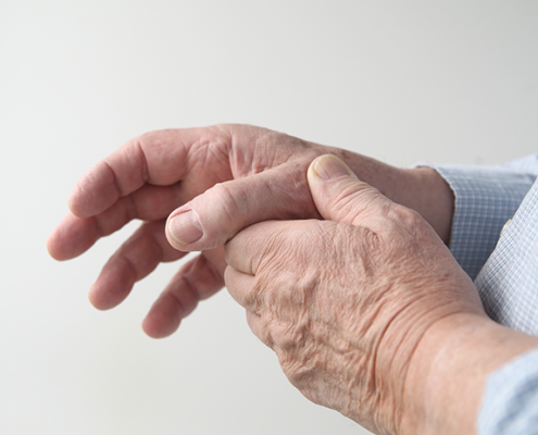 arthritis