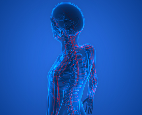 sciatic pain